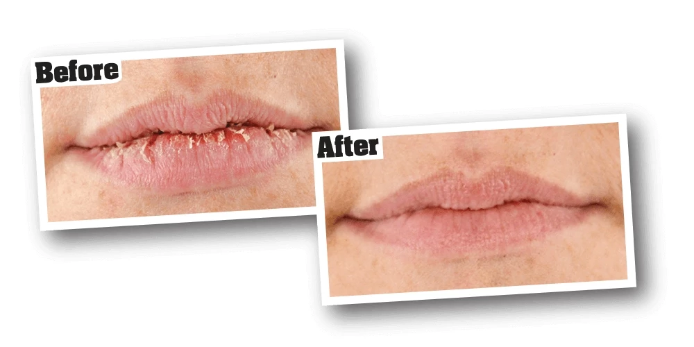 O'Keeffe's Lip Repair - Original 5 O'Keeffe's Lip Repair - Original - Image 3